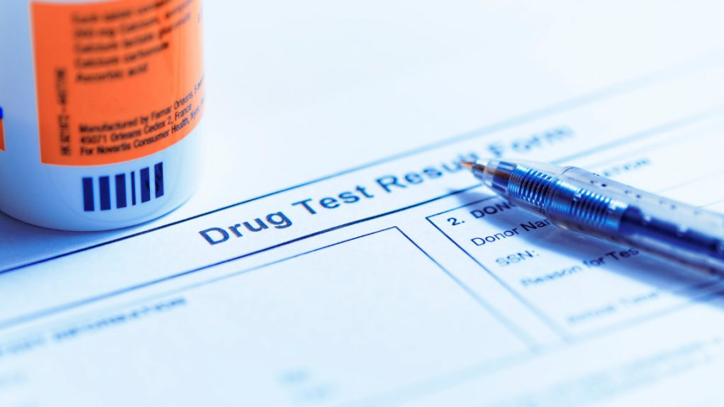 drug testing results form